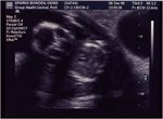 ultrasound3