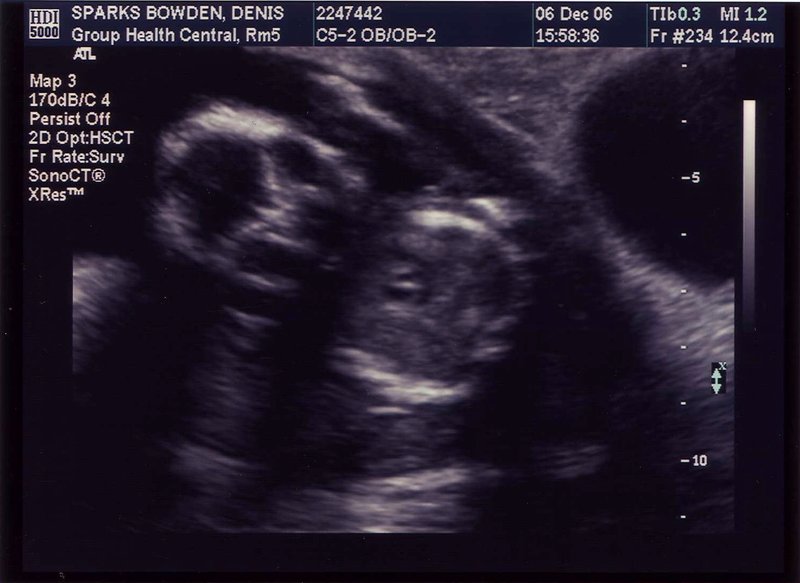 ultrasound3