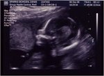 ultrasound5