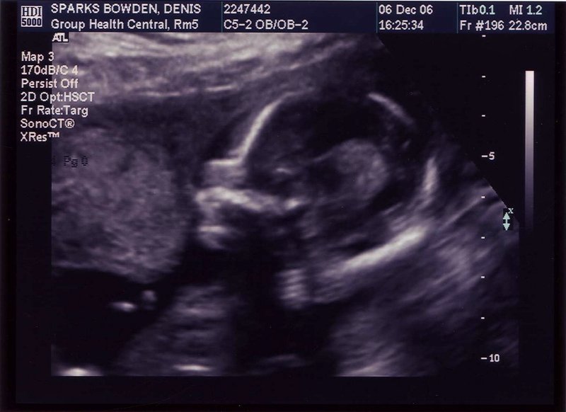 ultrasound5