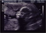 ultrasound6